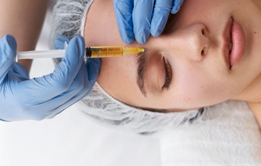 Microneedling