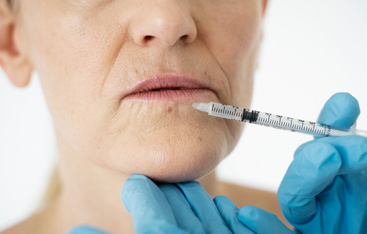 Microneedling