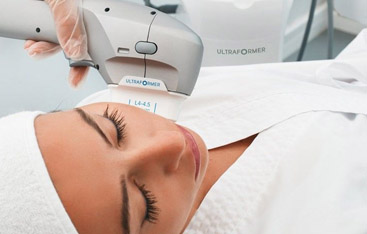Microneedling