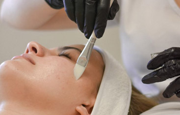 Microneedling