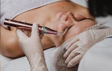 Microneedling