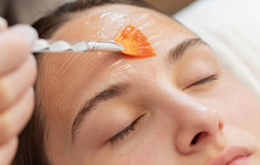 Microneedling