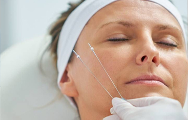 Microneedling