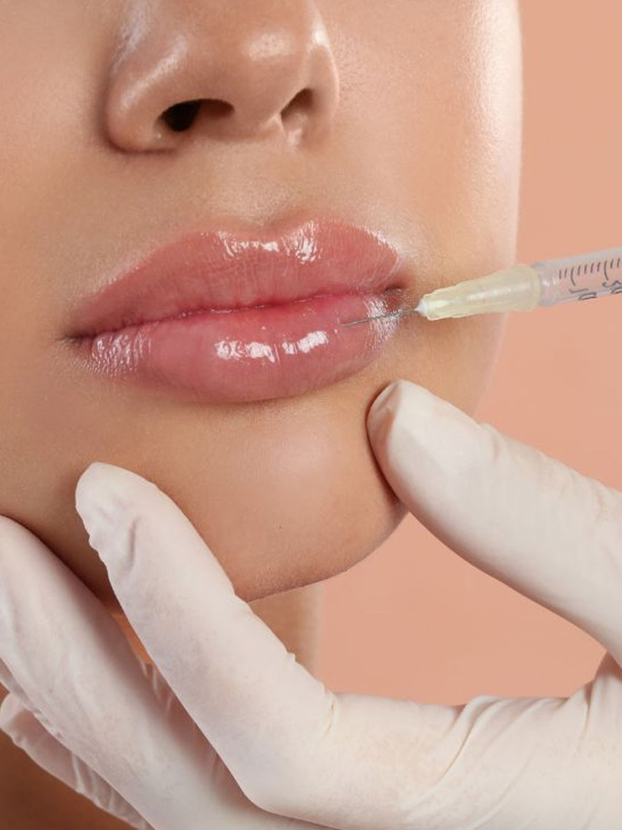 Medicina estetica Peeling