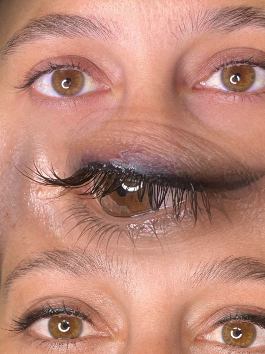 Micropigmentacion Microneedling